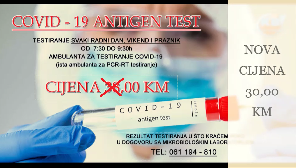 ANTIGEN TESTIRANJE U KANTONALNOJ BOLNICI